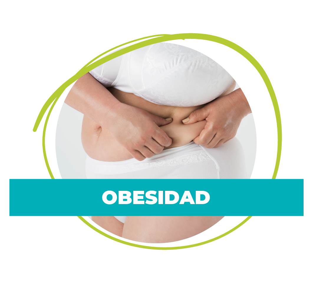 Obesidad